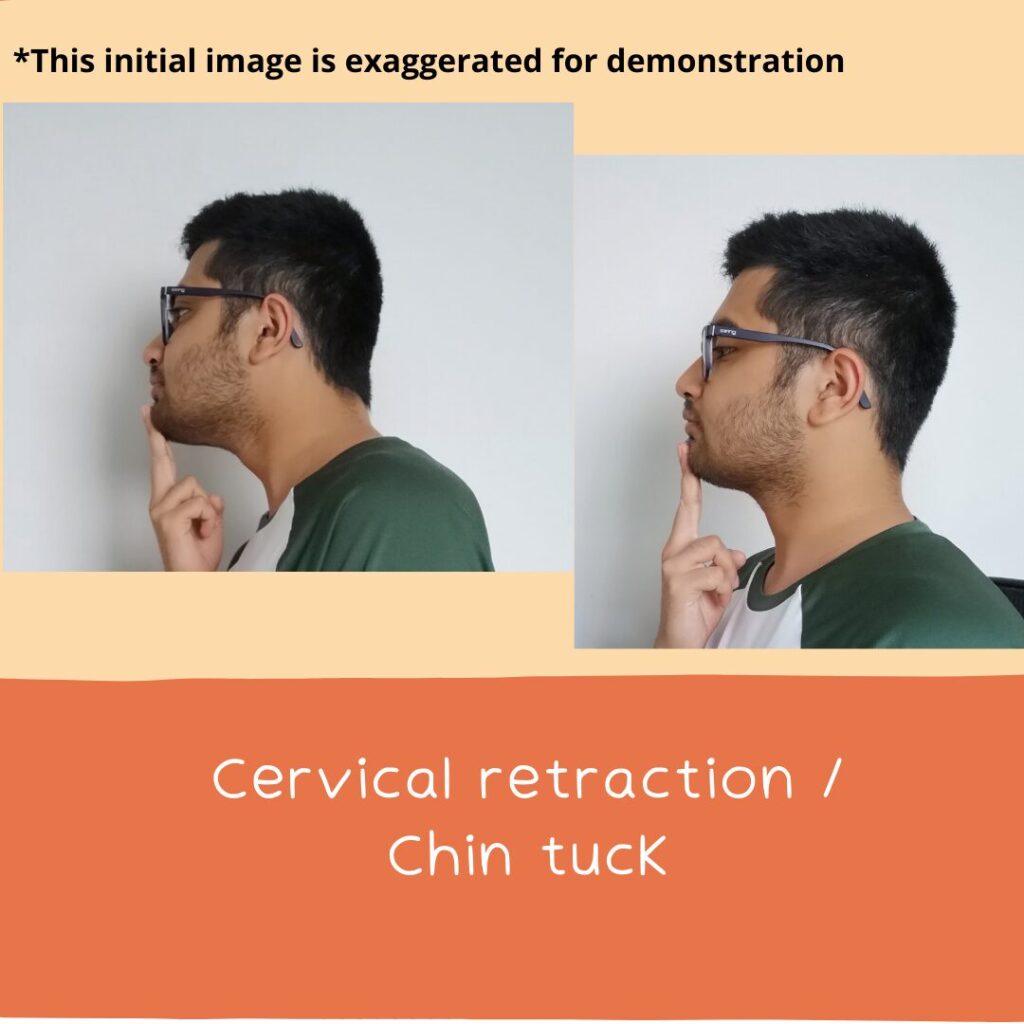 Man showing a common tech neck technique, the chin tuck, to help with tension headaches with a chiropractor’s help.