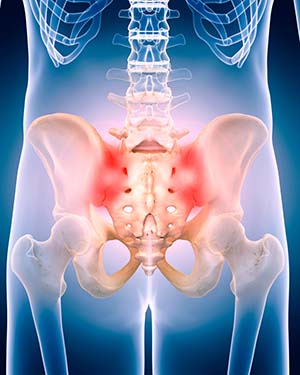 3D illustration of sacroiliac joint pain in the hips