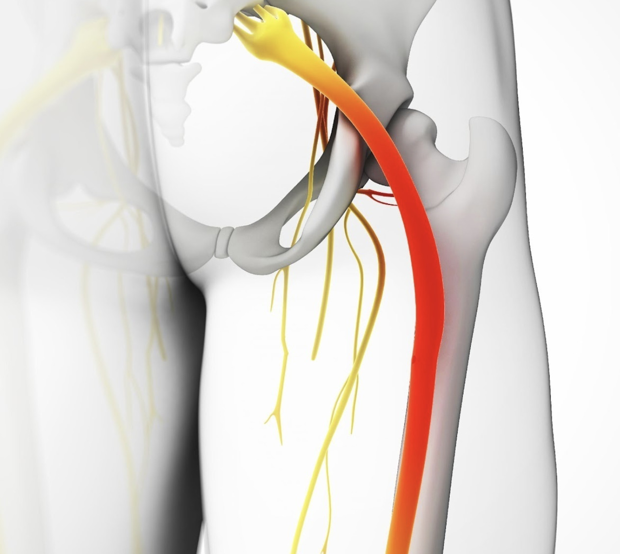how many treatments for sciatica with a chiropractor