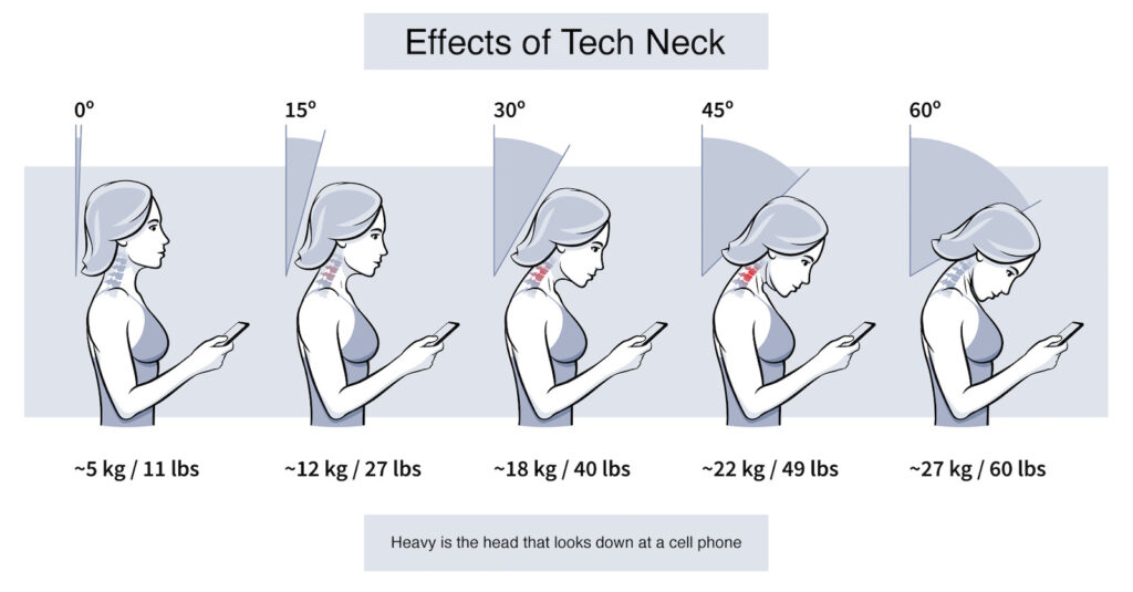 tech_neck_graphic
