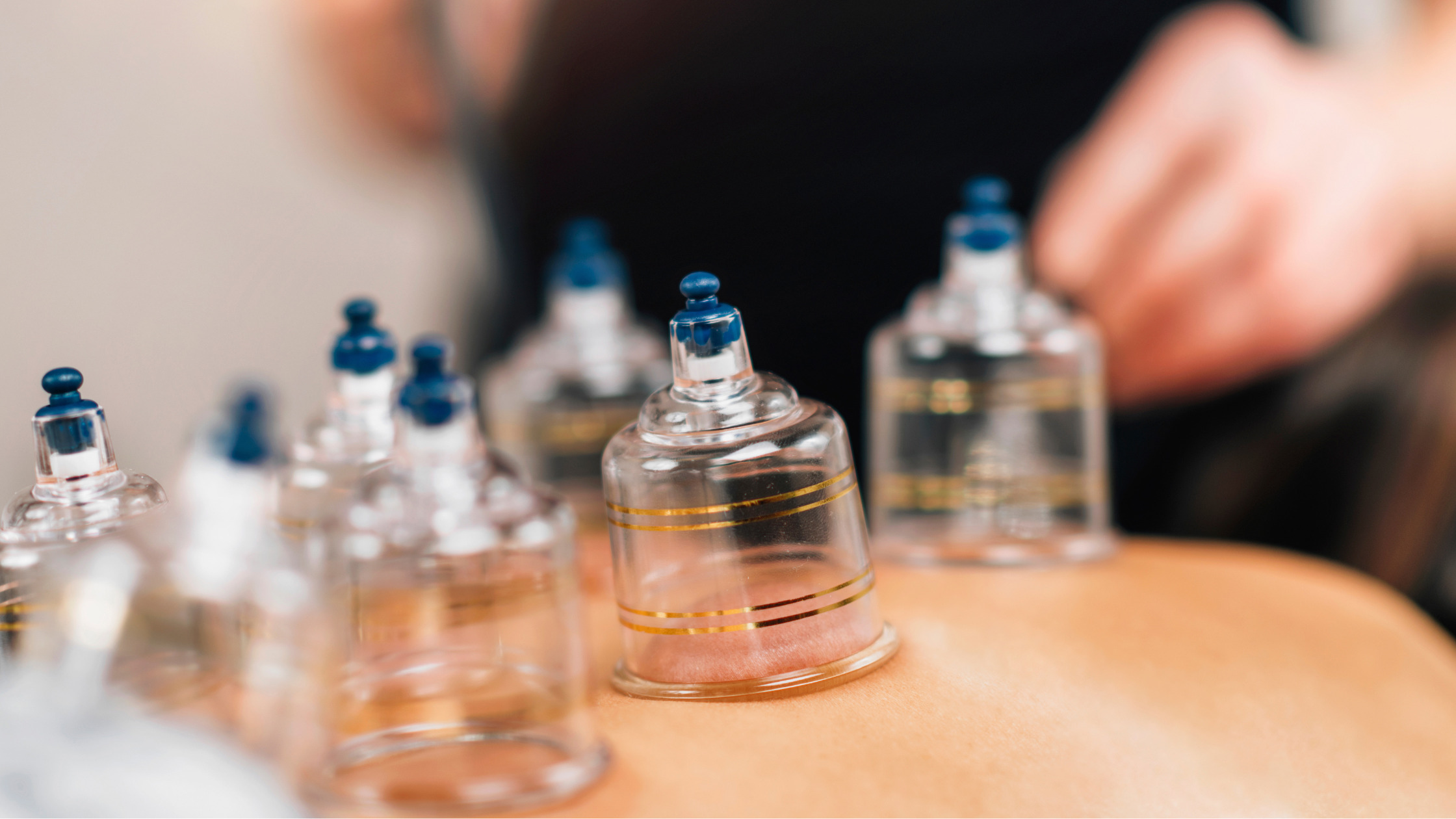 The Benefits of Cupping Therapy: What It Does for Your Body