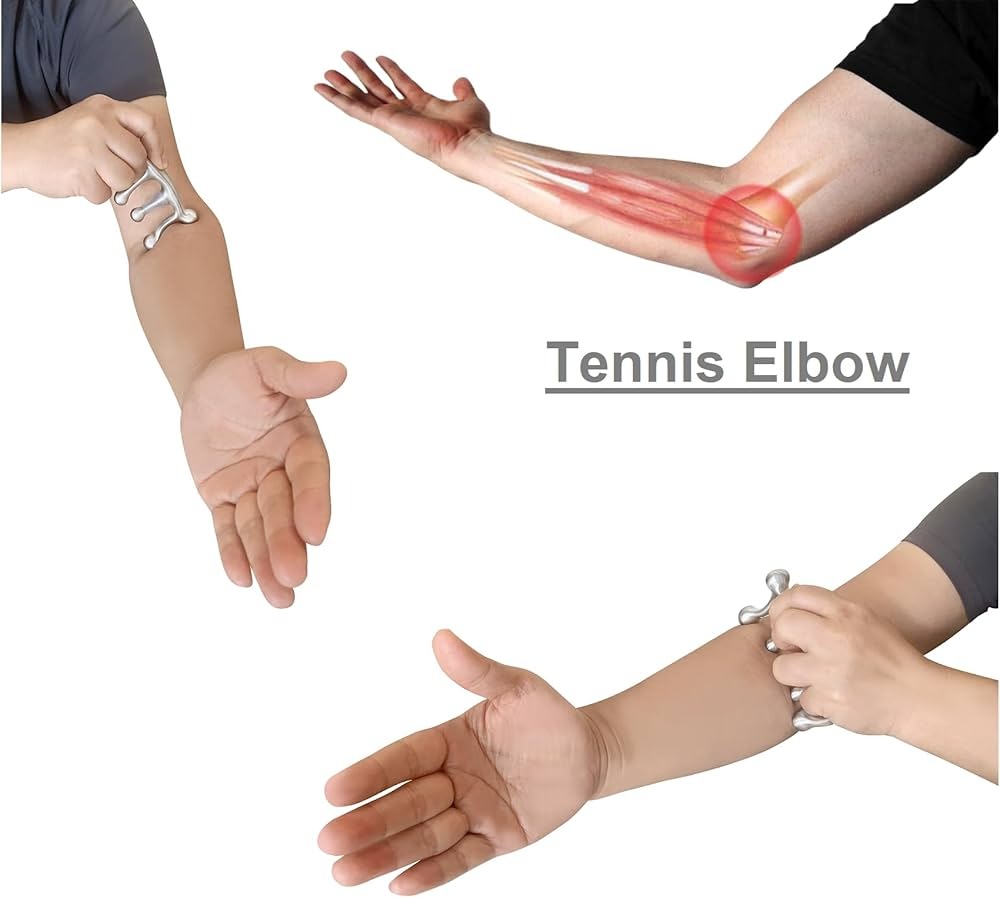 Can chiropractic care fix elbow pain, man’s arm showing common tennis elbow pain and practices.