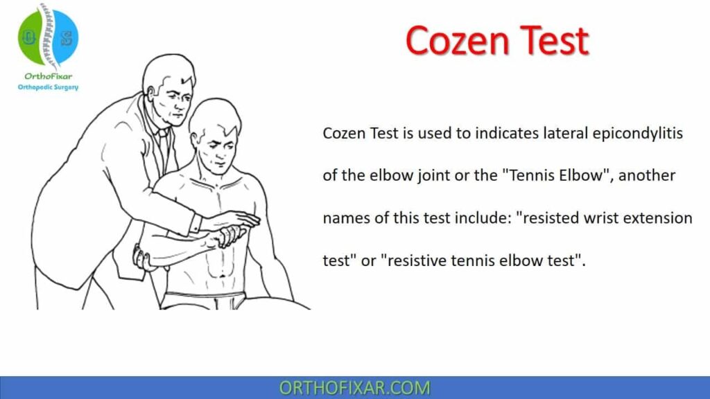 Drawing of chiropractor using the Cozen Test on patient to fix tennis elbow.